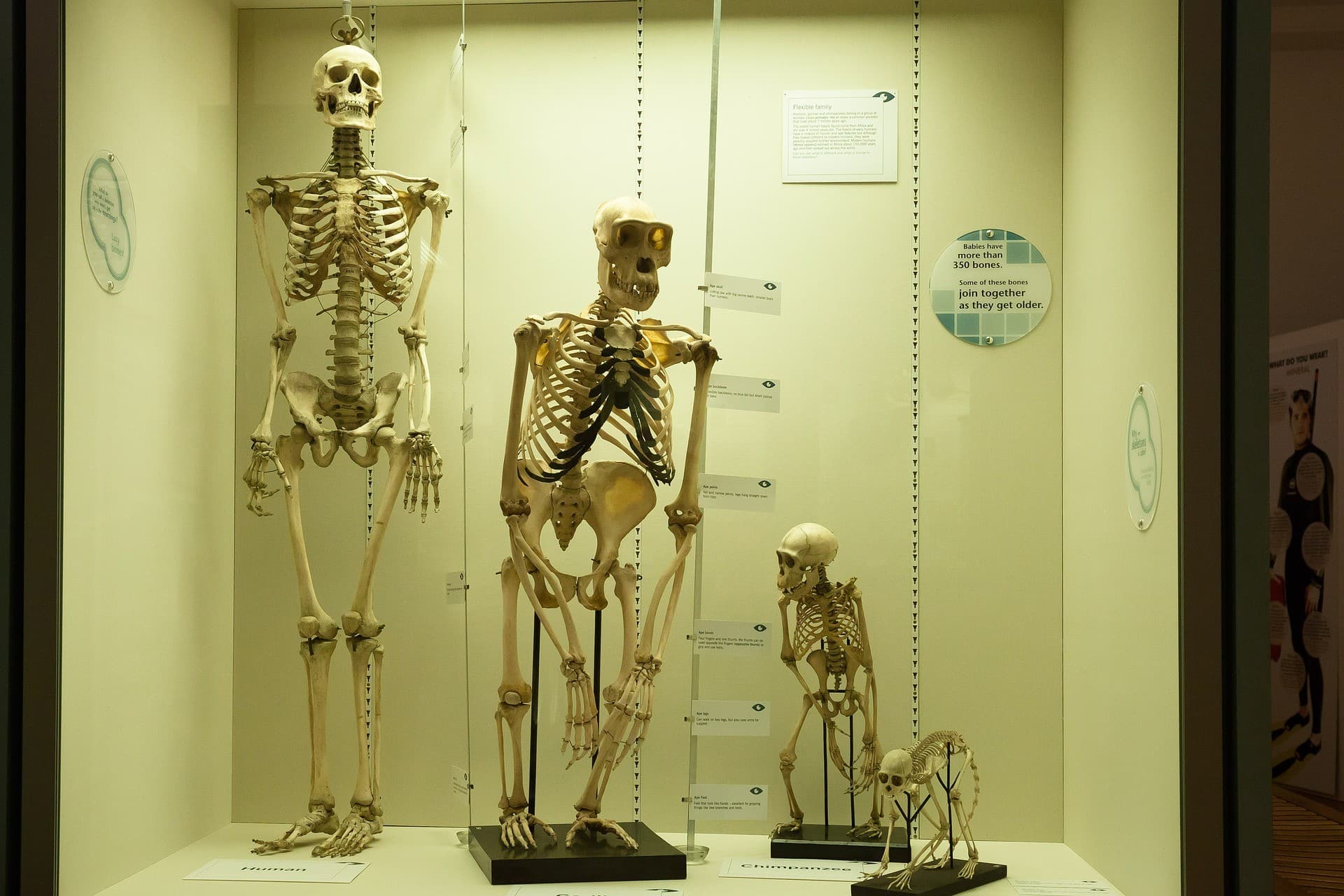 Skeleton displayed side by side